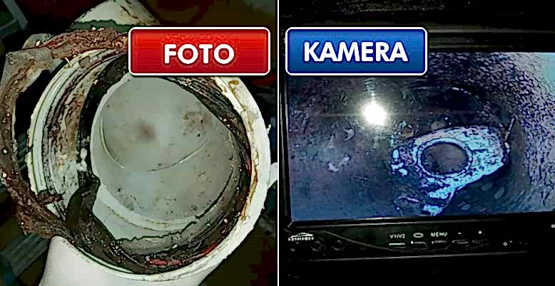 Bakı Pimaş Tıkanıklığı Açma